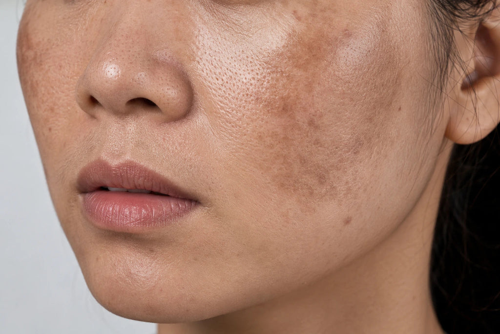 Lumo Tranexamic Facial Serum — original reference daily-care photography, used with permission