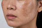 Lumo Tranexamic Facial Serum — original reference daily-care photography, used with permission