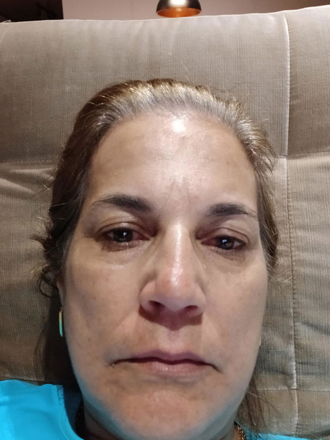Original photograph attached to a Zencial / EnvySkin review; not a Lumo customer