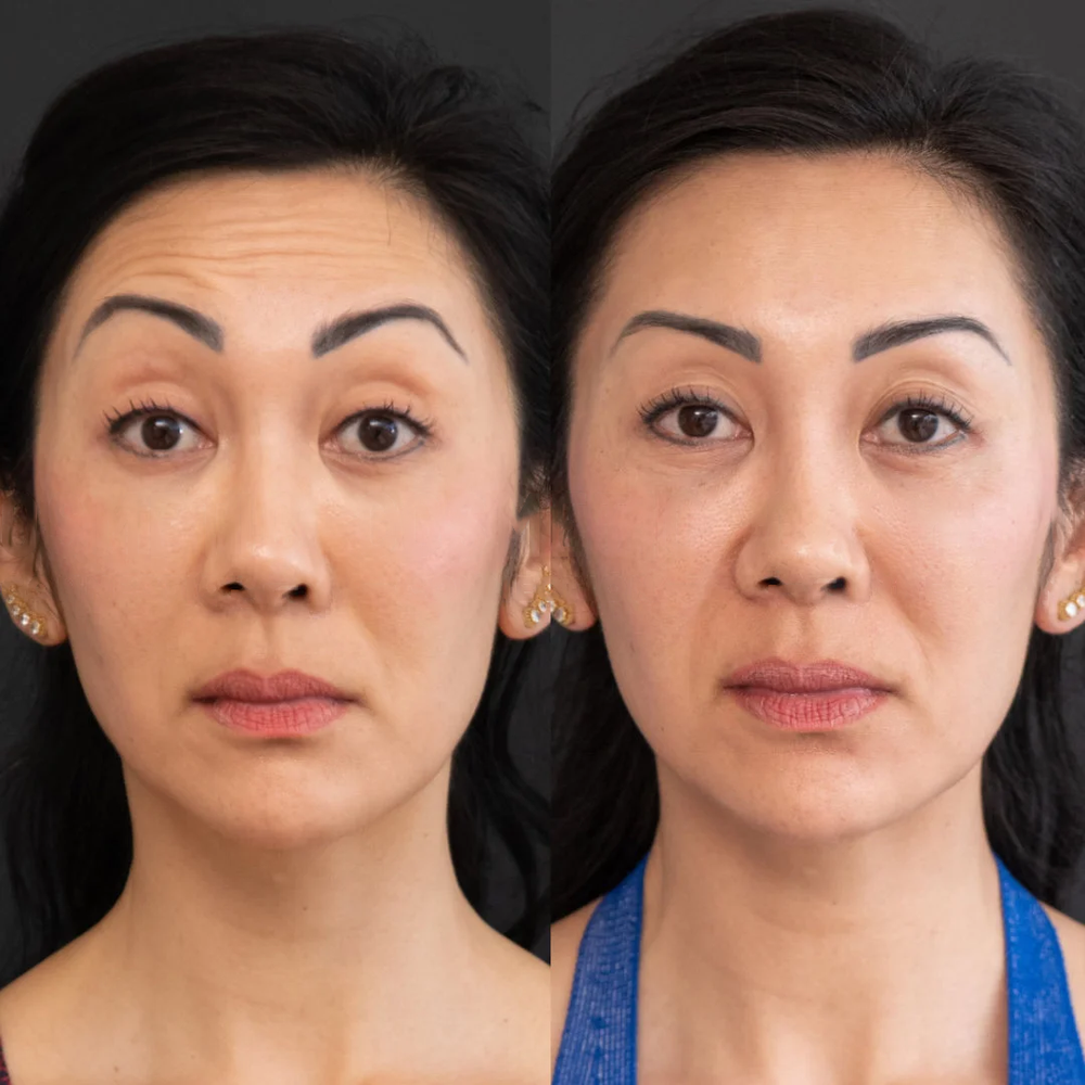 Original reference comparison from Zencial / EnvySkin; not verified Lumo results