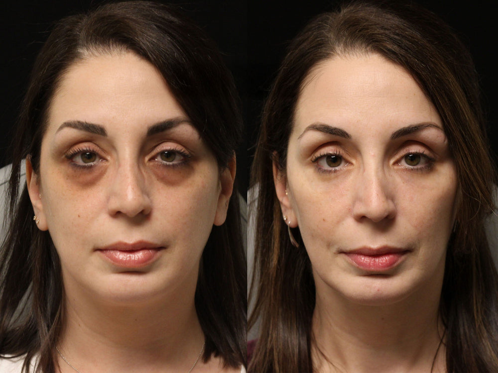Original reference comparison from Zencial / EnvySkin; not verified Lumo results